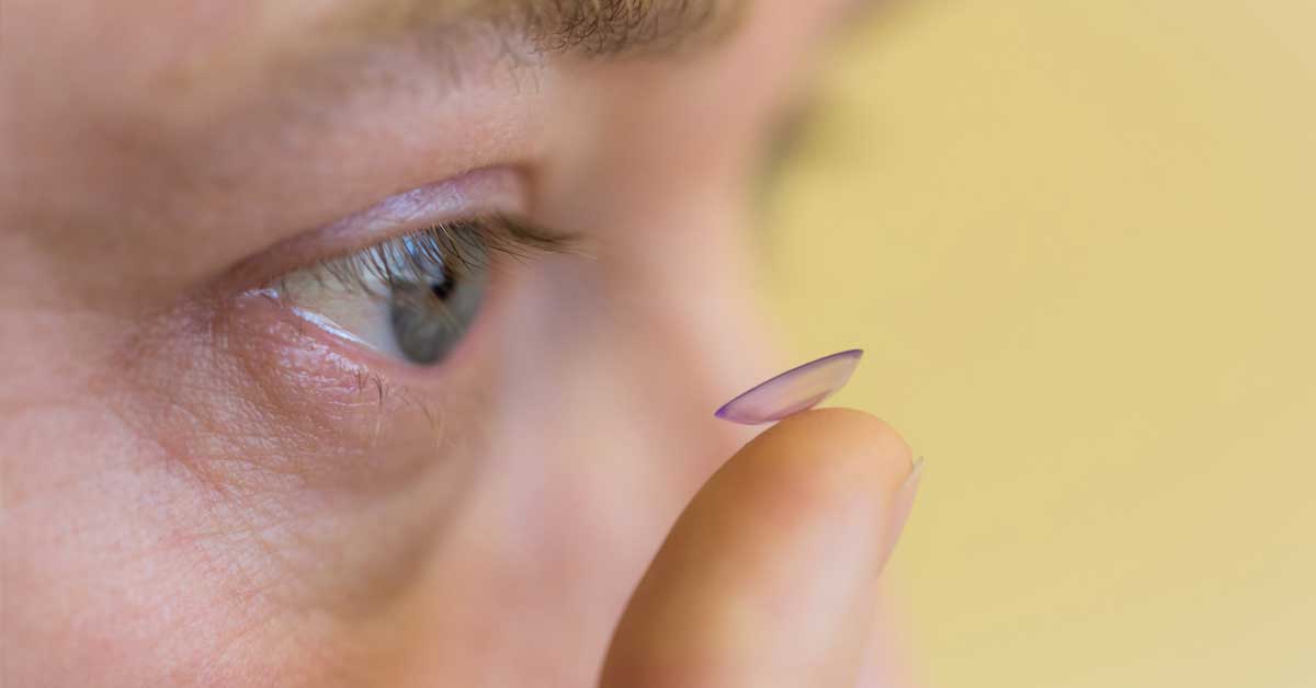 Orthokeratology for Myopia Control